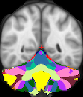 Buckner2011_JNeurophysiol_17networks_LiberalMask_axial.png