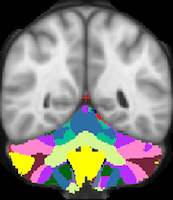 Buckner2011_JNeurophysiol_17networks_TightMask_axial.png