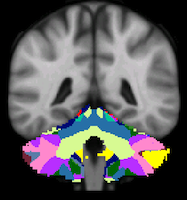 Buckner2011_JNeurophysiol_17networks_cerebellum-44.png