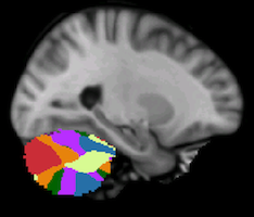 Buckner2011_JNeurophysiol_7networks_cerebellum-24.png