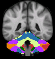 Buckner2011_JNeurophysiol_7networks_cerebellum-44.png