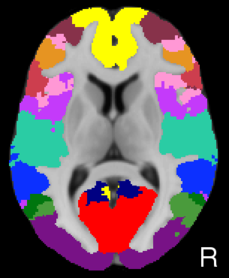 Yeo2011_JNeurophysiol_17networks_LiberalMask_axial9.png