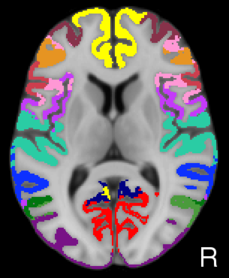 Yeo2011_JNeurophysiol_17networks_TightMask_axial9.png