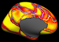 Yeo2011_JNeurophysiol_17networks_medial_confidence.png