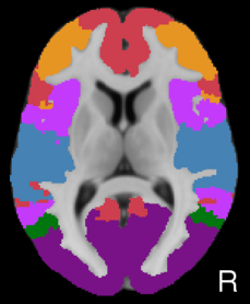 Yeo2011_JNeurophysiol_7networks_LiberalMask_axial9.png