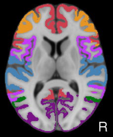 Yeo2011_JNeurophysiol_7networks_TightMask_axial9.png