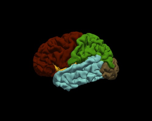 lh.lateral.pial.OAS1_0278_MR1.lobes.jpg