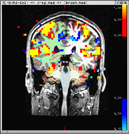 tkm-101-gam-cor.2-4.gif