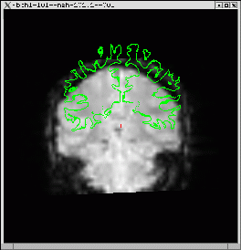 tkregister-before.gif