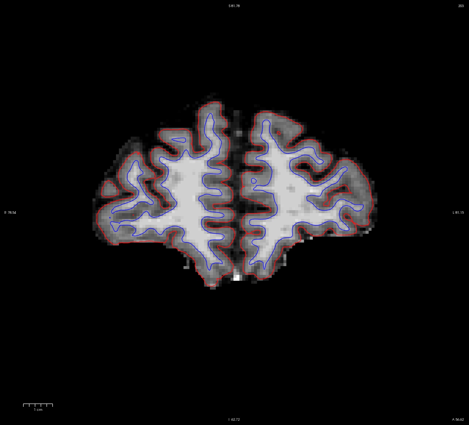 ps_slice_203_base_after.jpg