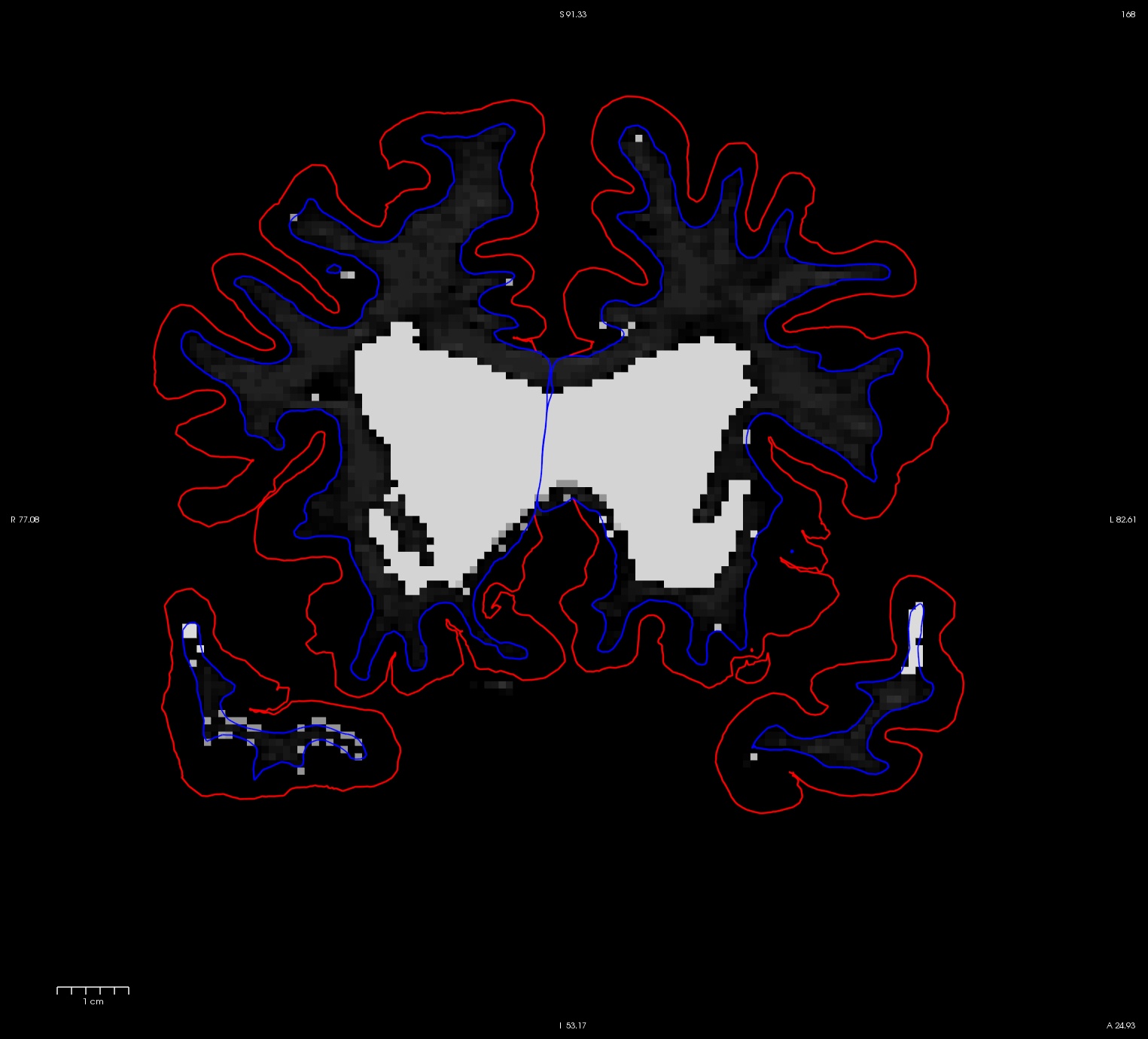 wm_slice_168_showing_voxels.jpg