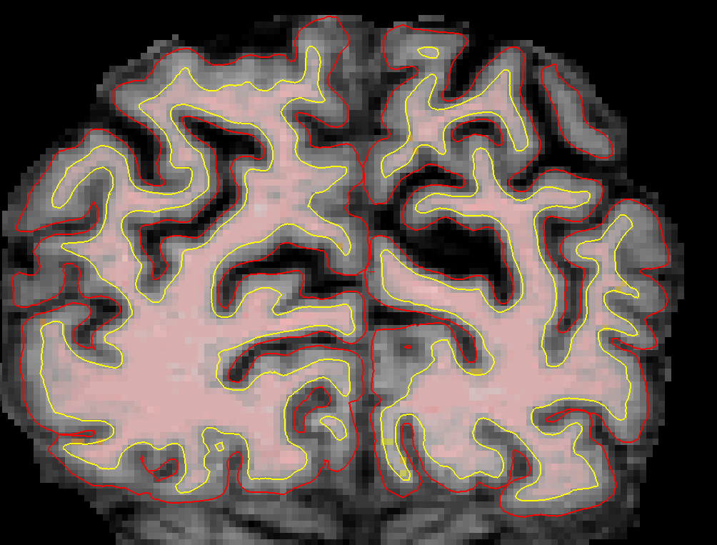 slice_57_corrected_2025.png