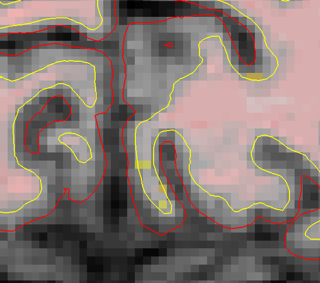slice_57_corrected_zoomed_2025.png