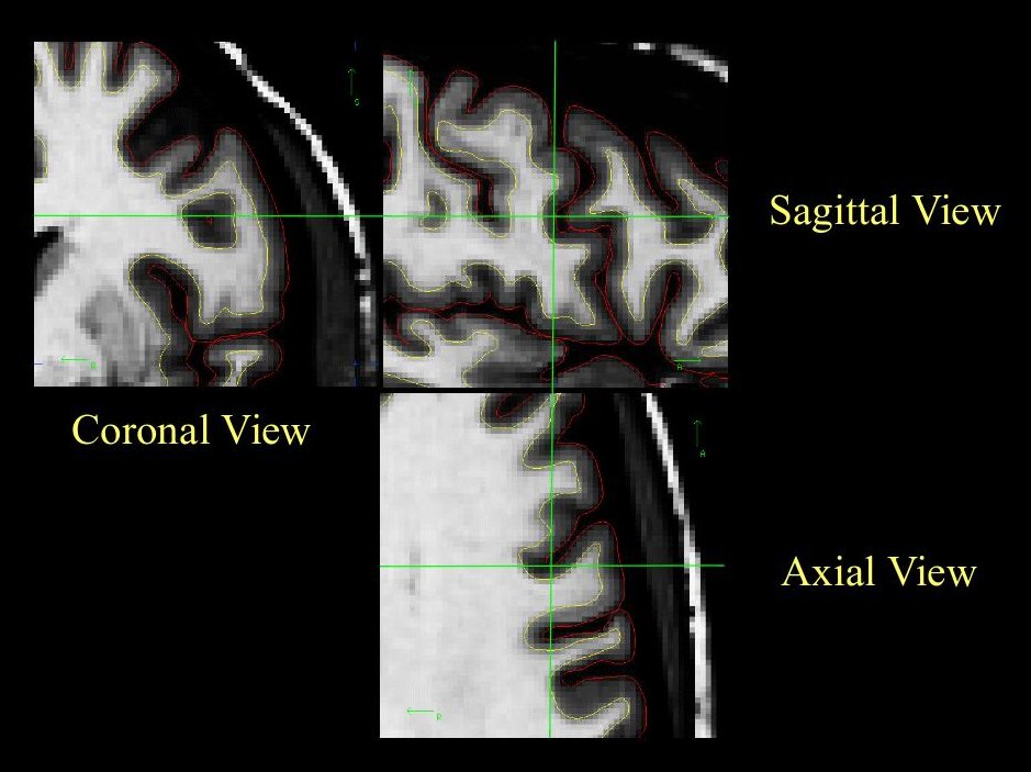 wmsegmentation_3views.jpg