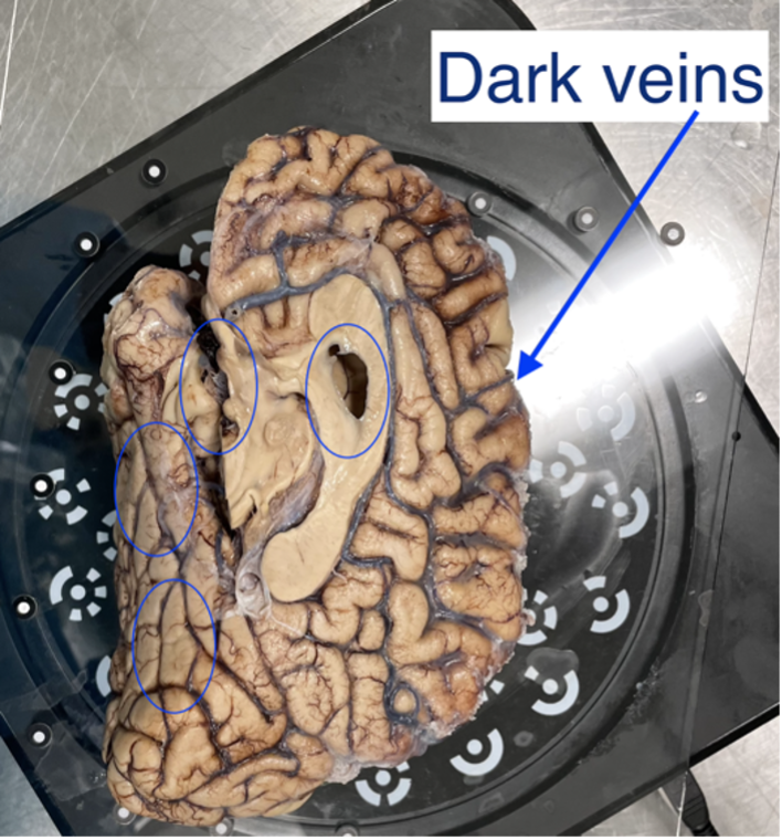 13_dark_veins.png