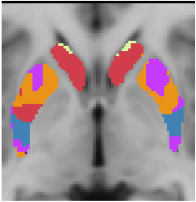 Choi2012_JNeurophysiol_7Network_striatum_axial_-2.png