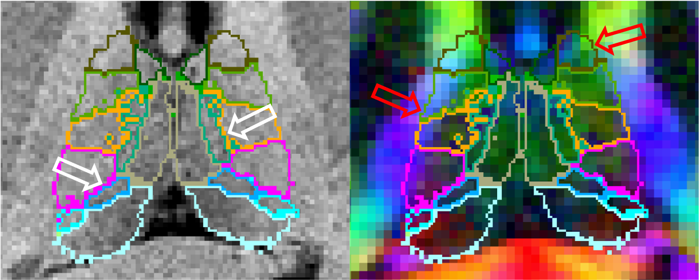 MissingStructuralBoundaries.png