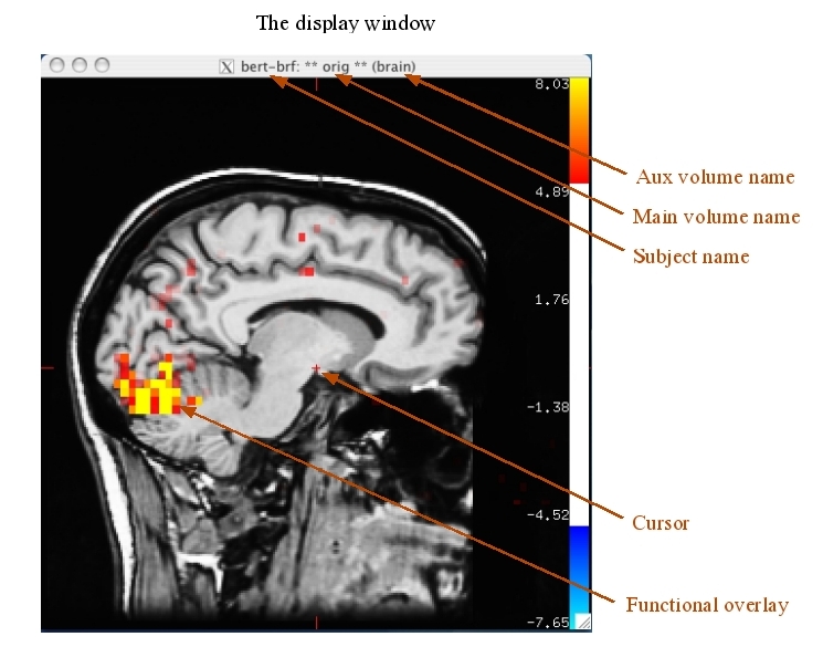 tkmedit_interface_display.jpg